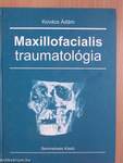 Maxillofacialis traumatológia