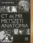 CT és MR metszeti anatómia