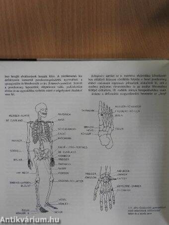 A lábizületek deformáló artrorisztájának jelzései és kezelése